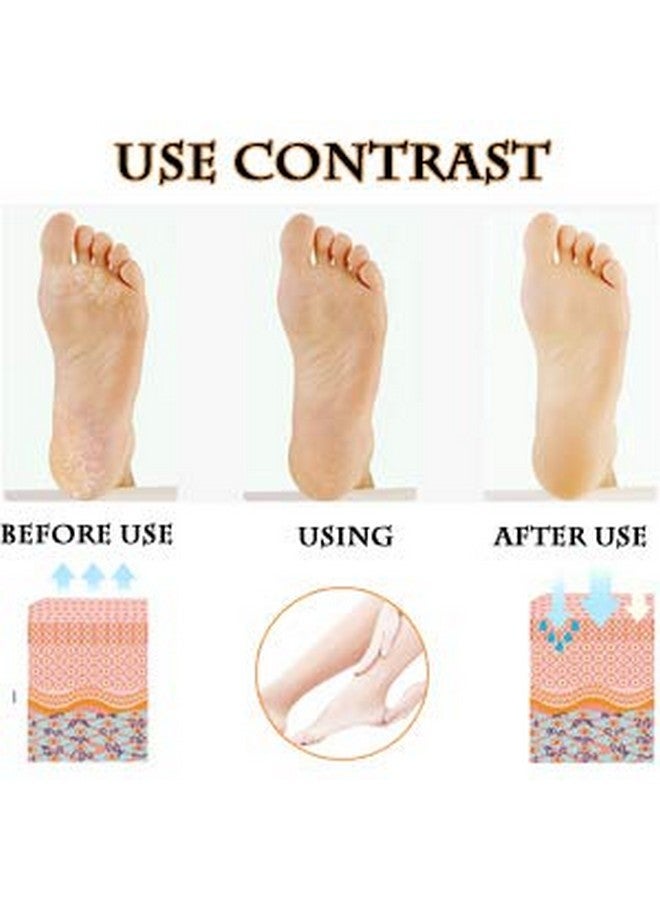 KPS جوارب كعب جل مرطبة تحمي أيضًا جلد القدم المتشقق، تخفيف الألم للرجال والنساء - Image 2