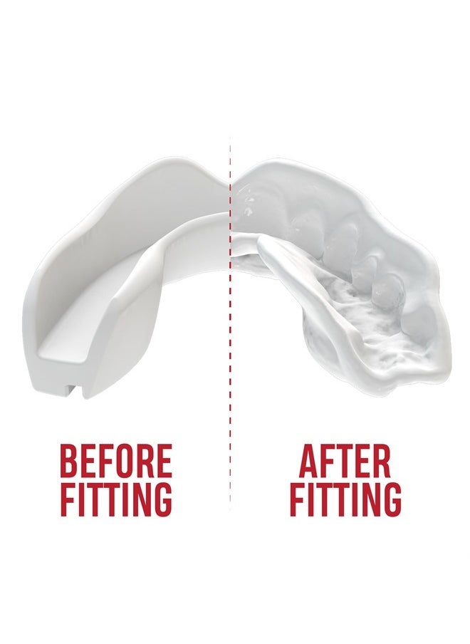 SAFEJAWZ Mouthguard Slim Fit, Adults and Junior Mouth Guard with Case for Boxing, Basketball, Lacrosse, Football, MMA, Martial Arts, Hockey and All Contact Sports (White, Adult)  - Image 4