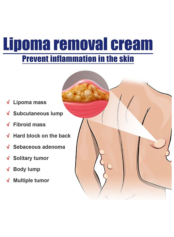 ساوث مون كريم إزالة الدهون ، كريم خال من الدهون ، كريم إزالة الدهون ، ومكافحة تورم الجلد كريم ، والقضاء على كتلة الدهون ، كريم العناية بالجسم - Image 5