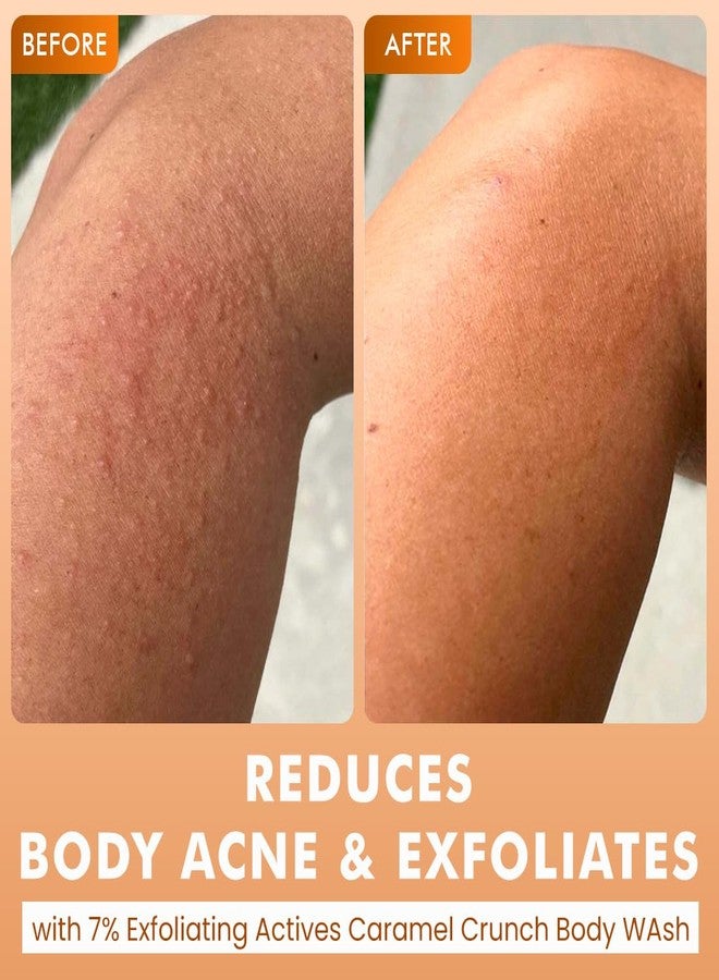 إم كافيين غسول الجسم mCaffeine لإزالة التصبغات وتقشير البشرة (مجموعة من قطعتين) | غسول الجسم برائحة الجوافة والكراميل المقرمش (300 مل × 2) | مع النياسيناميد وحمض الساليسيليك وحمض اللاكتيك | يفتح لون البشرة ويوحده | يقلل من حب الشباب في الجسم | هدية سانتا السرية للنساء/الرجال | سلة هدايا عيد الميلاد - Image 4