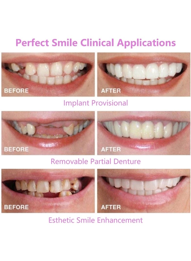 Generic Teeth Veneers Whitening Dentures Imitation Braces Temporary False Teeth Cover Perfect Smile Comfortable Fit Denture Kit  - Image 3