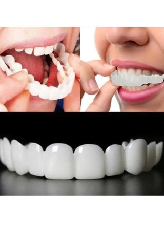 Teeth Veneers Whitening Dentures Imitation Braces Temporary False Teeth Cover Perfect Smile Comfortable Fit Denture Kit - pzsku/Z727BCB69CEB38F4E3238Z/45/_/1704871692/b2969582-dd37-4242-83df-a3a93a1d5403