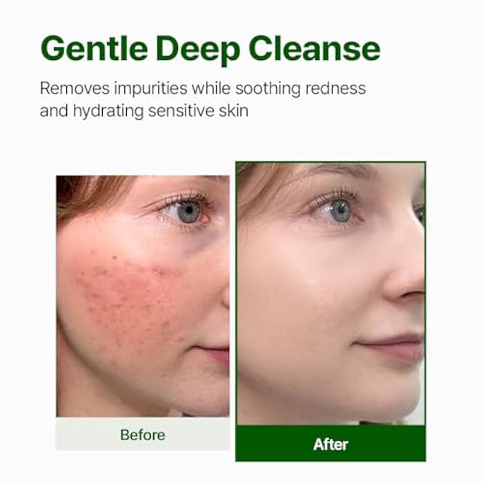 NACIFIC Cica PDRN Gel Cleanser 6.76 fl oz 200ml, Centella Asiatica, Low pH Deep Pore Cleanser for Sensitive Skin, Soothing, Purifying Korean Face Wash, Stocking Stuffers, Christmas Gifts for Women - Image 3