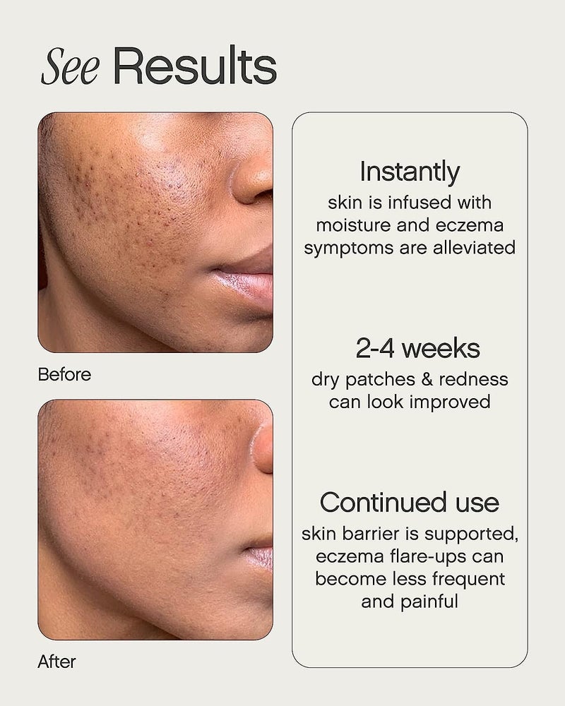 Topicals Like Butter Moisturizer for Dry, Sensitive & Eczema-Prone Skin - Soothing Instant Moisturizer and Eczema Relief for Face and Body, Skin Hydration (1.7 Fl Oz) - Image 3