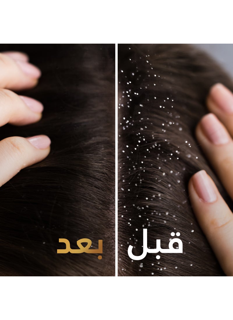 بانتين شامبو + بلسم ٢ في ١ من بانتين برو-في ضد القشرة 375مل - Image 5