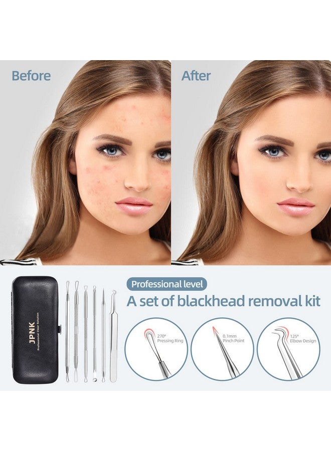 JPNK JPNK Blackhead Remover Tool Comedones Extractor Acne Removal Kit for Blemish, Whitehead Popping, 6 Pcs Zit Removing for Nose Face Tools with a Leather Bag - Image 3