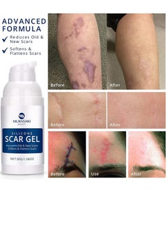 MURASAKI BEAUTY 100% Silicone Scar Gel Scar Cream - Advanced Scar Gel for Surgical Scars, C-Section, Stretch Marks, Acne, Injury, Burns, Keloids, Old and New Scars 1.06oz(30g)  - Image 2