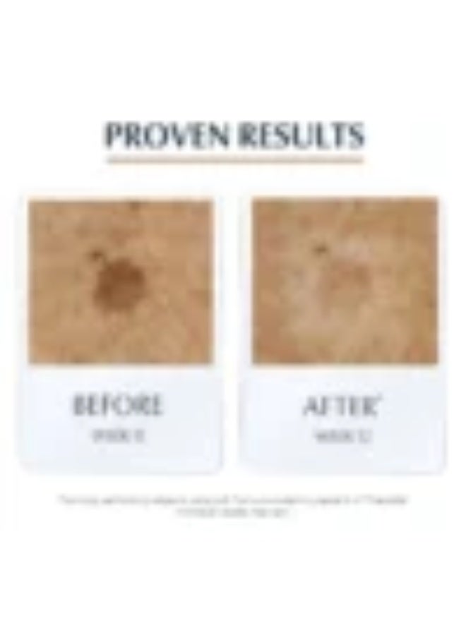 يوسيرين هيالورون فيلر مرونة ثلاثية الأبعاد، 30 مل - Image 5