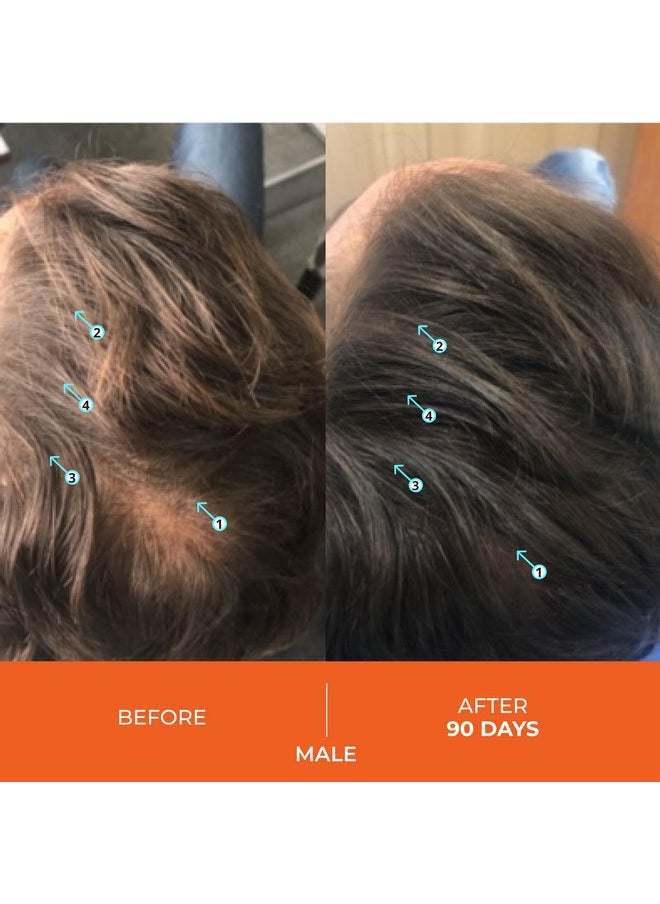 DS LABORATORIES - Revita Shampoo For Thinning Hair by DS Laboratories - Volumizing, Thickening Shampoo for Men and Women, Supports Hair Growth, Hair Strengthening, Sulfate Free, 7 Fl Oz (205mL) - Packaging May Vary - Image 1