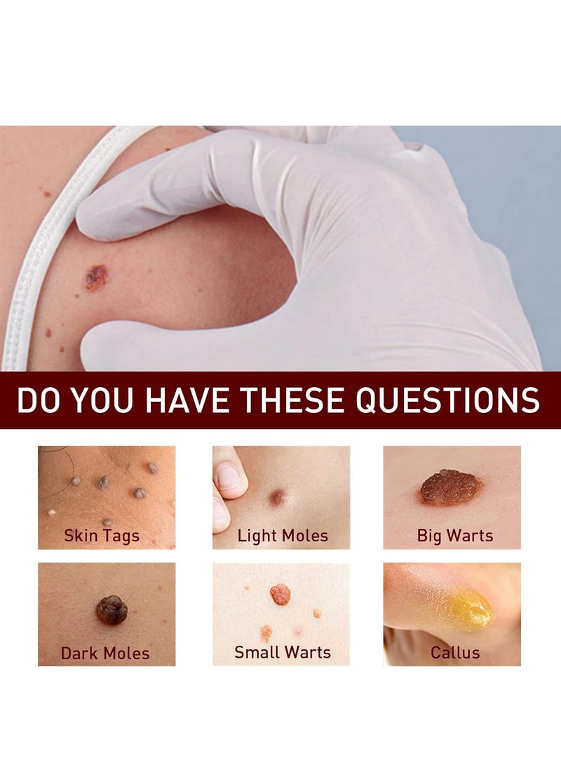 DubaiGallery قلم إزالة الشامات والعناية بالبشرة سريع وآمن بمكونات طبيعية وفعالية عالمية لإزالة الشامات - Image 4