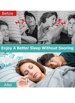 Oasisgalore 8 Pack Anti Snoring Nose Vents Devices Nasal Dilators, Snore Reducing Snore Stopper  - Image 2