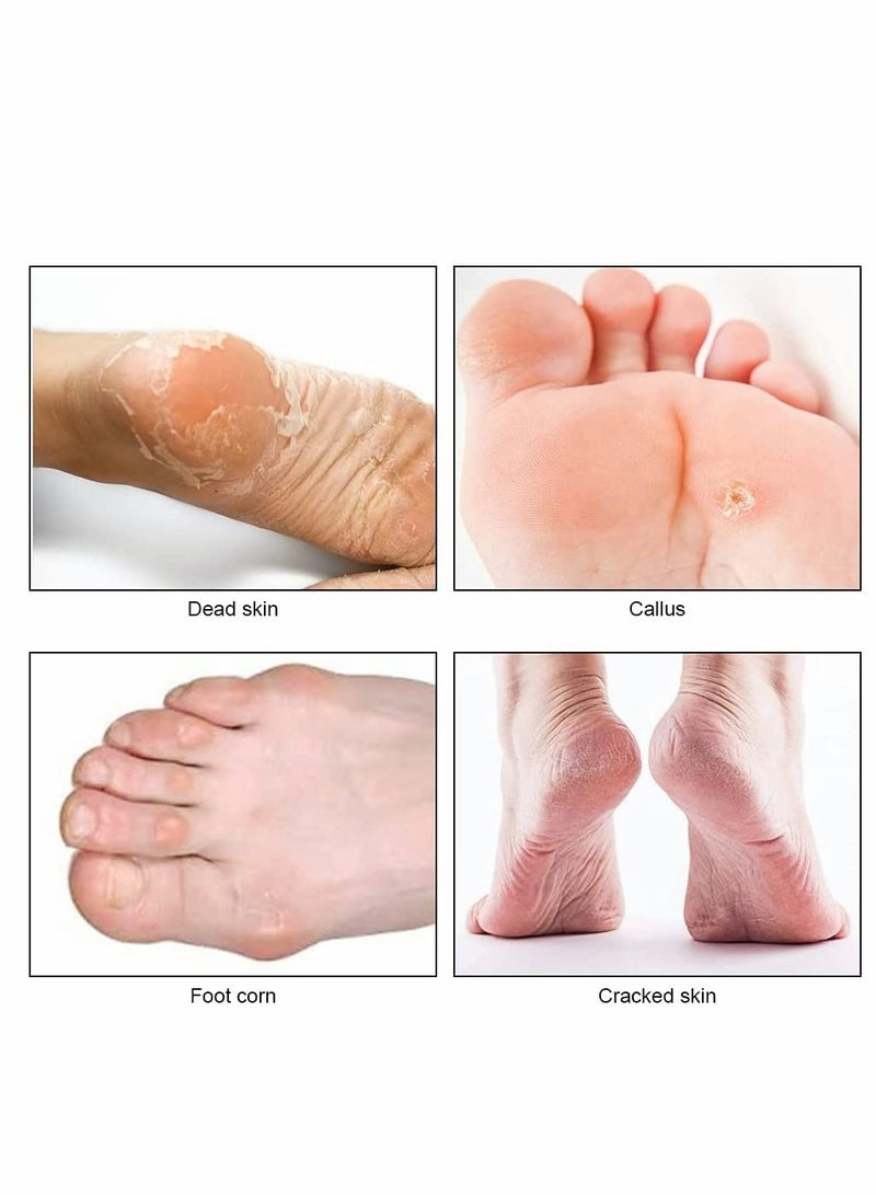 سيوسي ملفات القدم للبشرة الصلبة ، مكشطة القدم 2 في 1 ومزيل الجلد الصلب مع 10 استبدال ، مجموعة أدوات الحلاقة الاحترافية المصنوعة من الفولاذ المقاوم للصدأ للعناية بالقدم (قطعة من الجبن) - Image 3