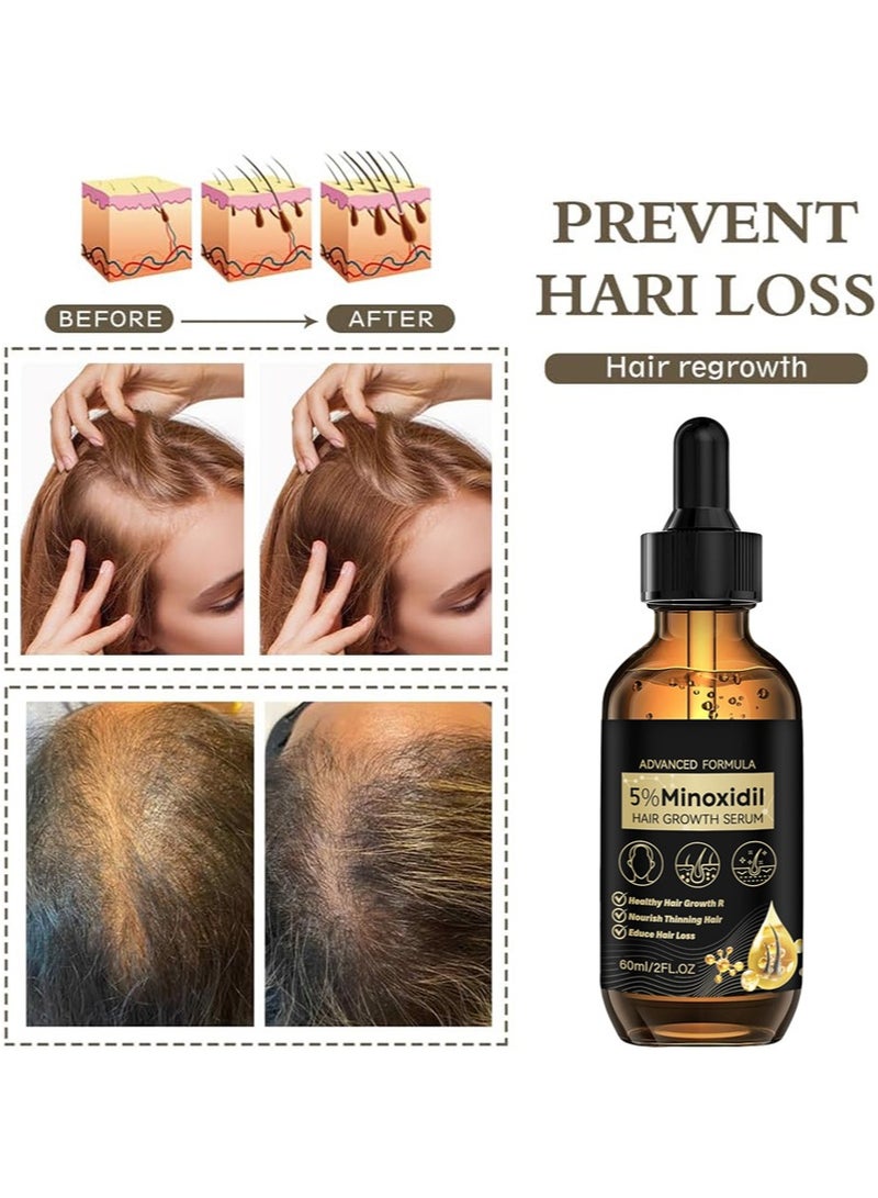 MOOYAM Minoxidil Biotin 5% Hair Growth Serum Oil for Men and Women,Prevents Hair Loss and Thinning, 2 fl oz - Image 4