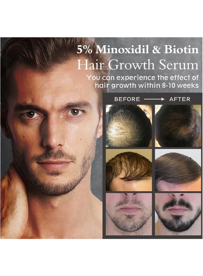 MOOYAM Minoxidil Biotin 5% Hair Growth Serum Oil for Men and Women,Prevents Hair Loss and Thinning, 2 fl oz - Image 2