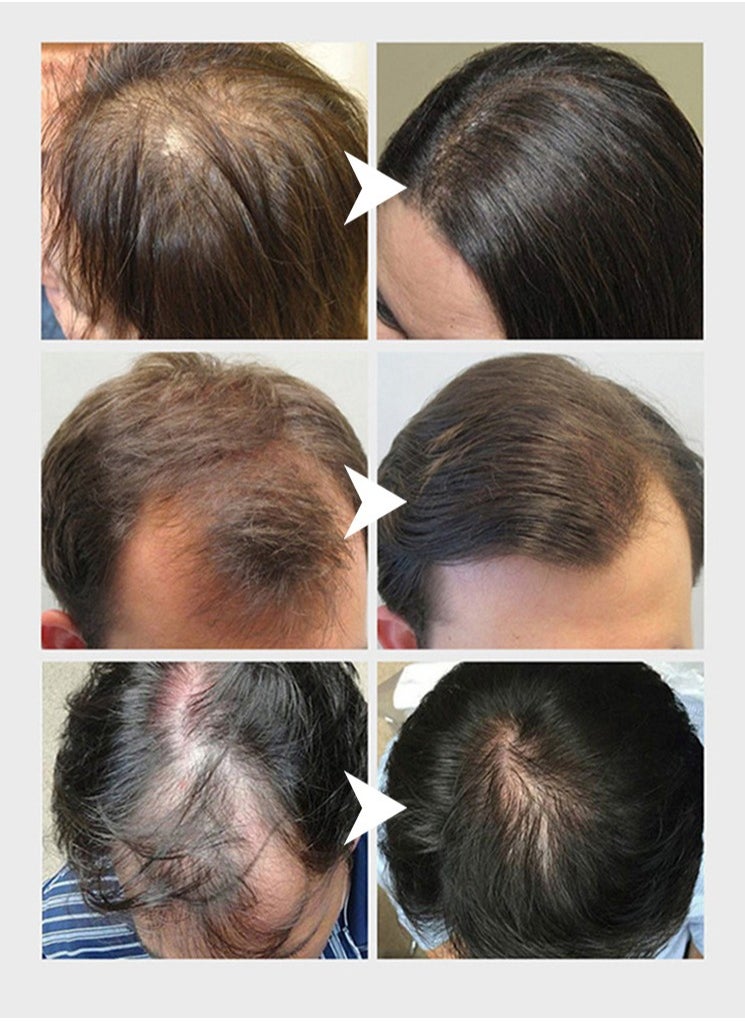 Lanthome - Hair growth with rice hair growth solution quality hair growth treatment products effective hair growth treatment for thinning and fragile hair - Image 1