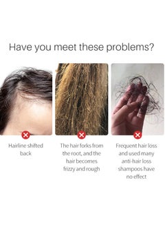 Lanthome Hair growth with rice hair growth solution quality hair growth treatment products effective hair growth treatment for thinning and fragile hair  - Image 5