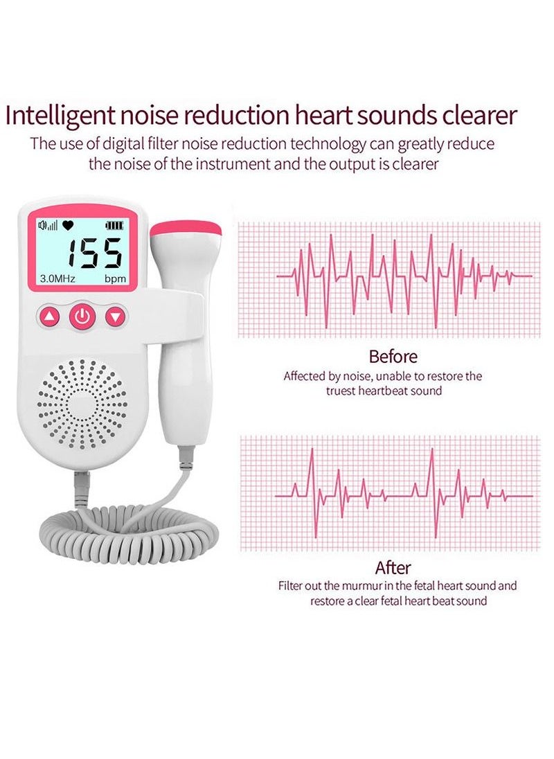 General - Portable Ultrasound Doppler Fetal Heart Rate Monitor with LCD Screen - Image 1