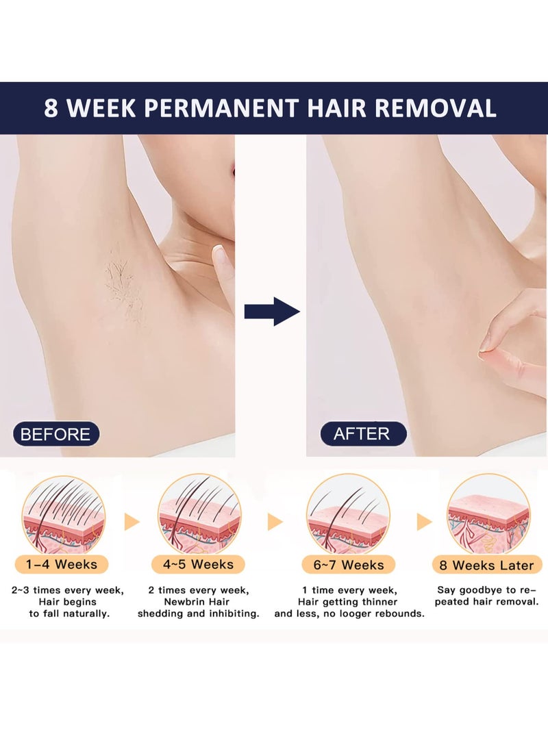 ملاي جهاز T14 IPL لإزالة الشعر بالضغط مع عدسة بيكيني باللون الأزرق الداكن - Image 5