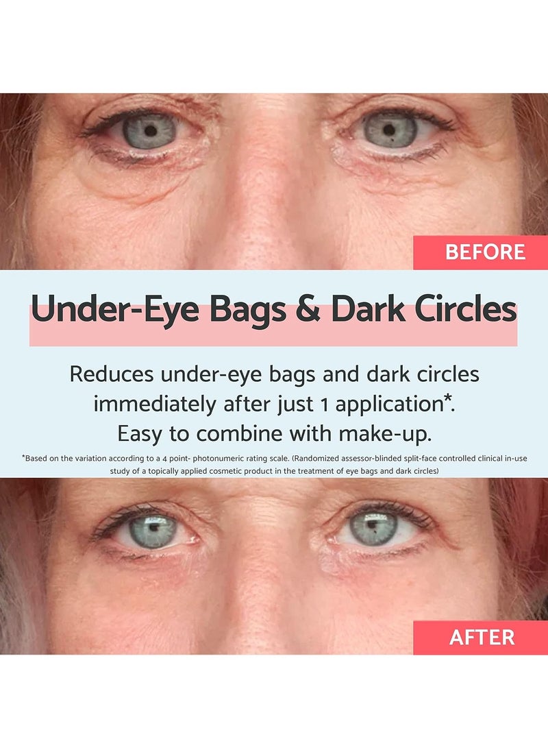 remescar Eye Bags and Dark Circles 8ml Dark Circle Eye Cream for Under Eye Bags and Remove Bags Under Eyes Instant Eye Bag Remover 180 Applications - Image 4