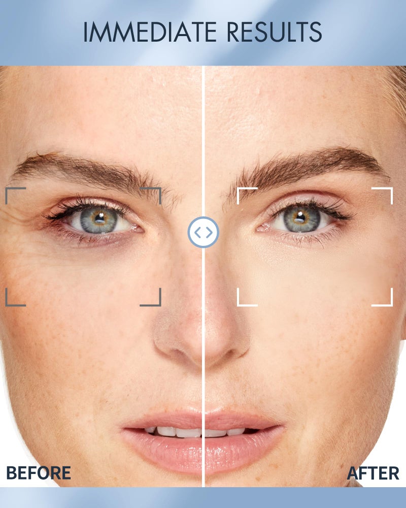 depology Replenish & Repair Under Eye Patches for Puffy Eyes, Wrinkles (60 Patches) | Hydrating with Ceramides and Hyaluronic Acid for All Skin Types | Botanical Extracts Eye Gel Pads 2.96 fl oz - Image 4