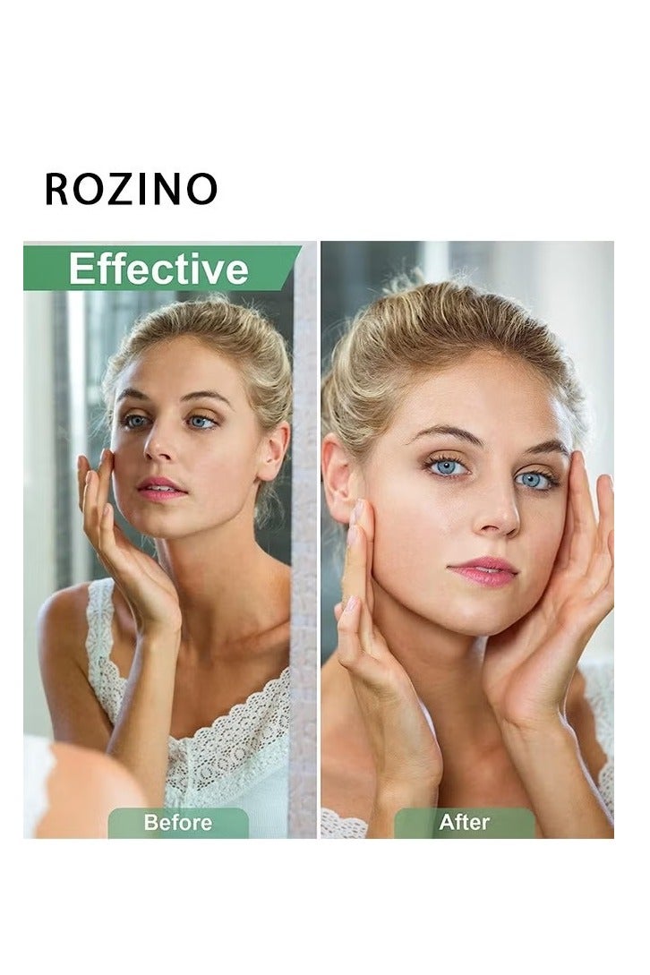 روزينو 30 قطعة (4.5*9cm) شرائط شمع سريعة وفعالة لإزالة الشعر للحواجب العلوية الشفاه الشفاه. - Image 5