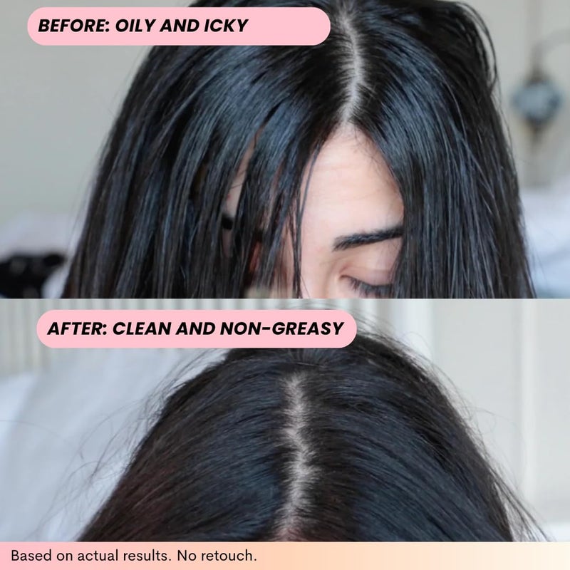 FoxyBae Volumizing Dry Shampoo Spray for Women - With Biotin for Hair Growth - For Dark, Brunette & Blonde Hair - Refreshing & Non-Toxic - Image 3