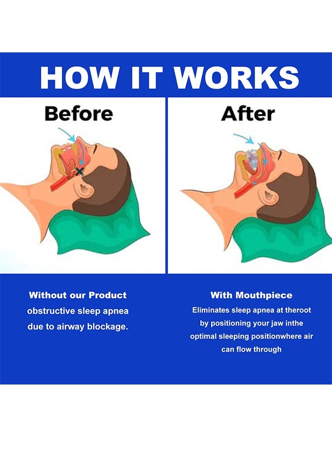 EELHOE Anti-Snoring Mouth Guard, Reusable Mouth Guard For Stop Snoring At Night Anti Snoring Devices With Comfort Size Snore Mouth Guard For Men Women  - Image 4