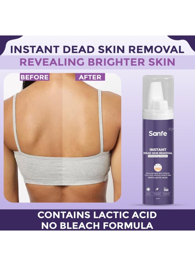 Sanfe Instant Dead Skin Removal Exfoliating Mousse | Visibly Removes Tan, Exfoliation in Minutes | For Smooth & Bright Skin | 60 ml - Image 2