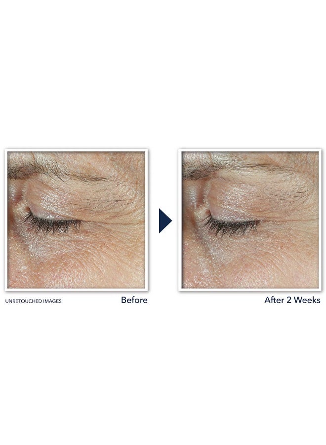 RoC RoC Skincare Derm Correxion Dual Eye Cream 2 x 10ml  - Image 4