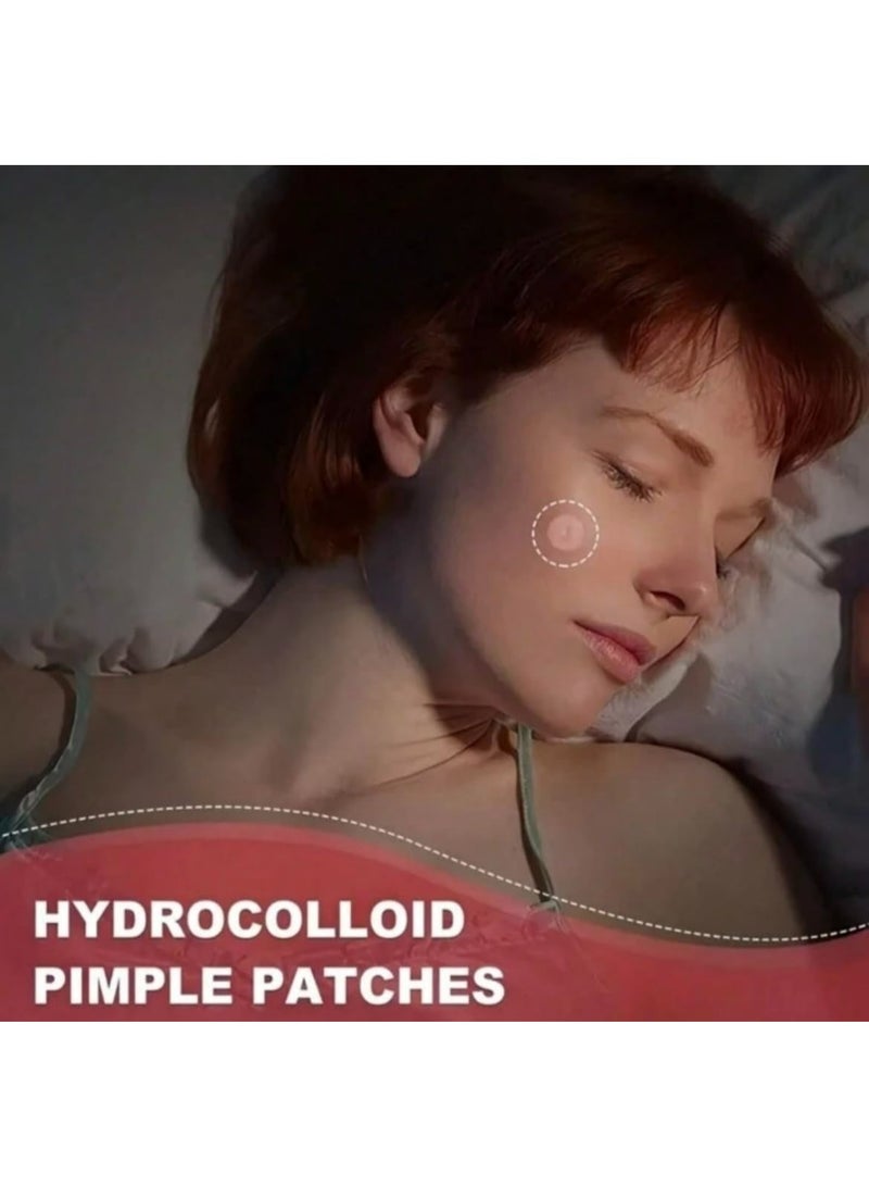 LUMYA 360PCS Hydrocolloid Acne Patches for Face, Invisible Waterproof Spot Treatment Stickers, Gentle for Sensitive Skin, Assorted Sizes for Daytime Wear (Clear)  - Image 5