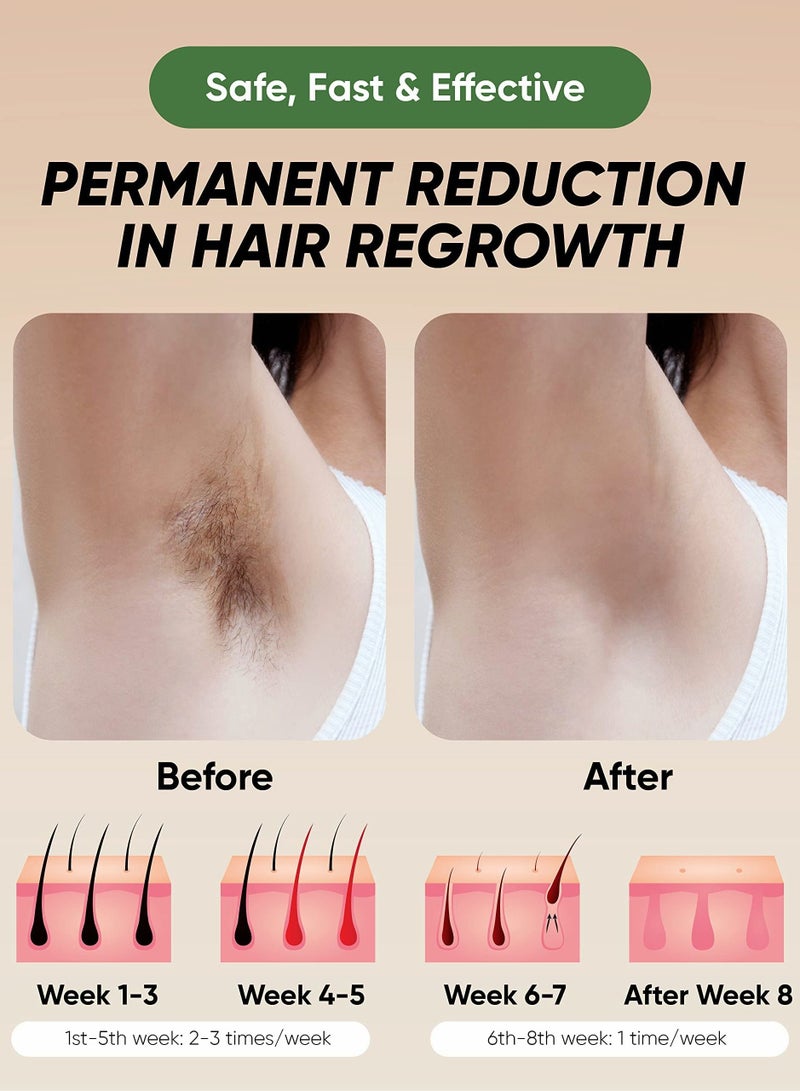Excefore Hair Removal, At-Home IPL Hair Removal for Women and Men Hair Removal, - Image 5