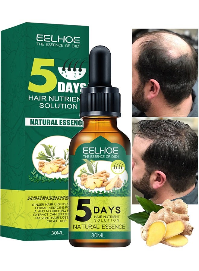 إيلهو جوهر نمو الشعر ، لعلاج تساقط الشعر ، وتجديد الشعر وفروة الرأس ، زيت الزنجبيل الأساسية لدعم صحة الشعر علاج ترقق الشعر للرجال 30 مل - Image 1