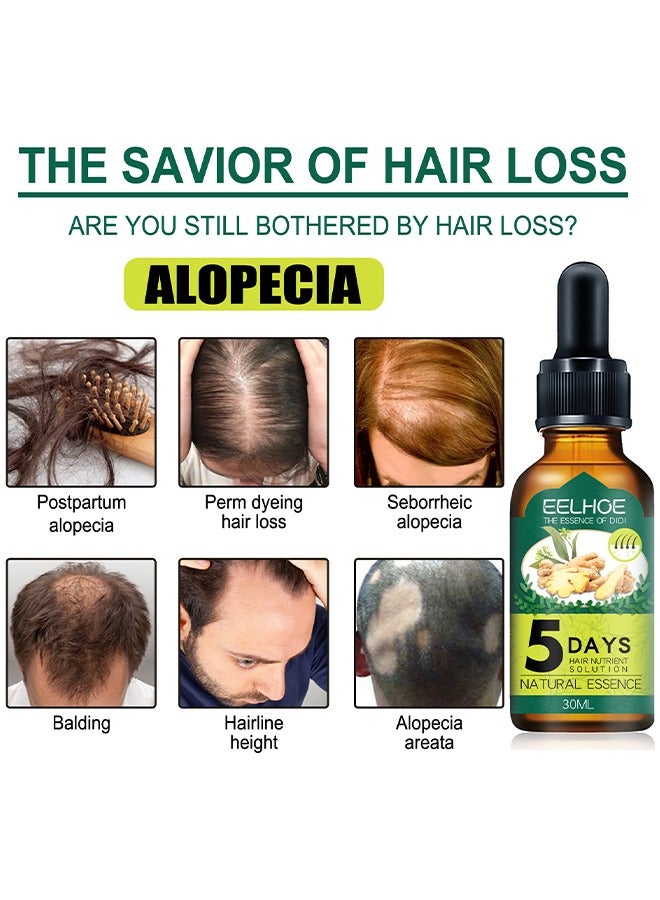 إيلهو جوهر نمو الشعر ، لعلاج تساقط الشعر ، وتجديد الشعر وفروة الرأس ، زيت الزنجبيل الأساسية لدعم صحة الشعر علاج ترقق الشعر للرجال 30 مل - Image 4