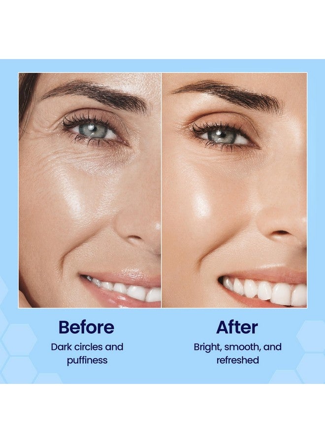 Honeyskin Eye Firm Antioxidant Nano Serum - with Hyaluronic Acid, Manuka Honey and Aloe Vera - Anti Aging and Anti Wrinkle - Spots and Hyperpigmentation Treatment (0.5oz) - Image 5