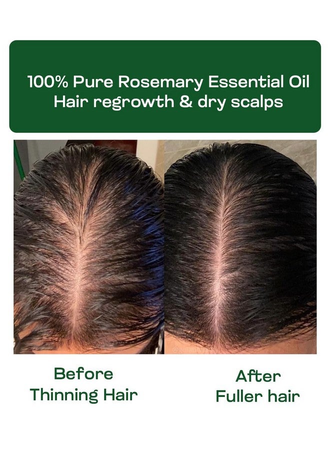 VITMINVEDA Pure Rosemary Real Essential Oil Premium - 15ml | For Hair Growth | Skin Glow | Unveil the Herbaceous Elegance for Holistic Well-being! - Image 2