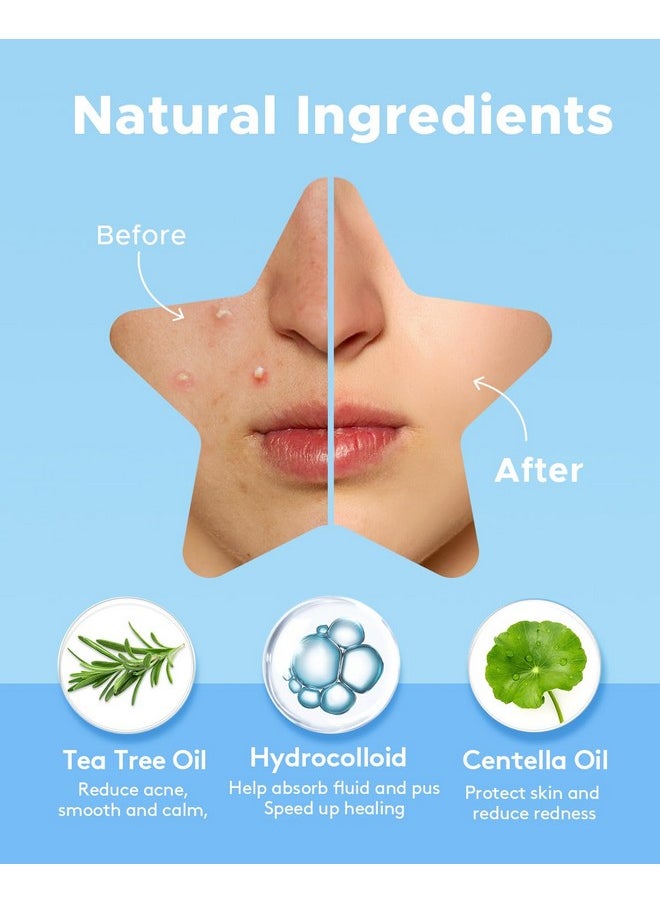 LitBear Acne Patch With Tea Tree & Centella Oil, 168 Hydrocolloid Dots In 6 Colors For Face - Cute Star Pimple Stickers  - Image 3