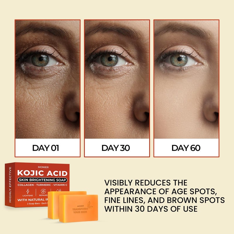 MONIER Kojic Acid Soap Dark Spot Remover Soap Bars with Collagen Turmeric Coconut Oil Vitamin C Vitamin E Moisturizing Nourishing Original Japanese Complex - Image 2