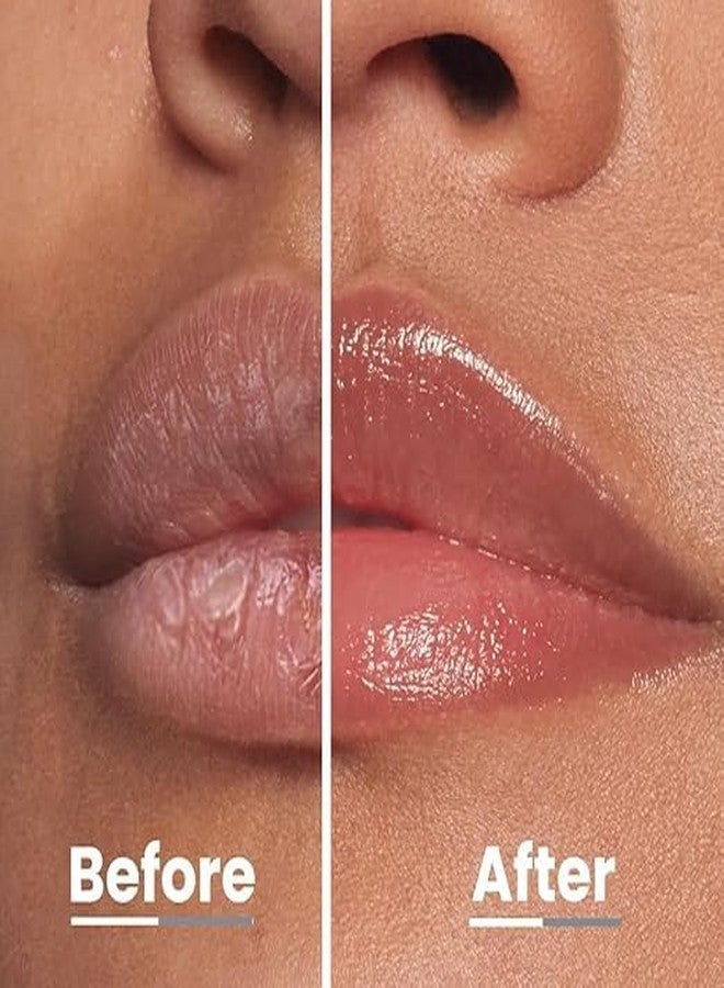 ADOERE 5 In 1 Lip Defence Tinted Balm for Dark, Dry, Chapped and Pigmented Lips, Gives 24 hours moisturization, Peptide Lip Balm for Women 100% Active Natural Ingredients - 10gm (Rose) - Image 3