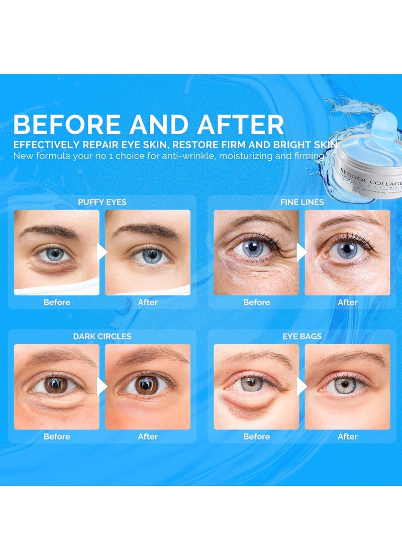 EnaSkin Under Eye Patches for Dark Circles: 30 Pairs Enaskin Naturals Retinol Collagen Eye Gels Mask - Reduce Wrinkles Puffy & Bags - Skin Treatment Pads - Anti Aging Moisturizer For Women (Blue) - Image 2