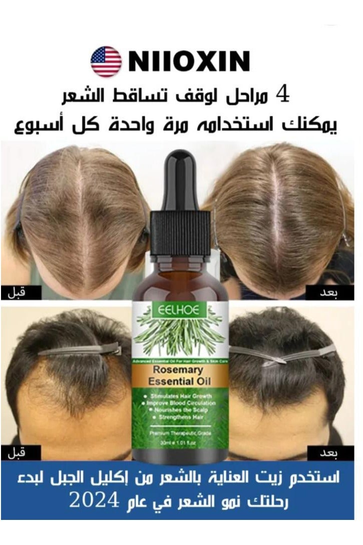 إيلهو زيوت إكليل الجبل العطرية ، زيت إكليل الجبل النقي لنمو الشعر والعناية بالبشرة ، وتغذية فروة الرأس ، ويحفز النمو