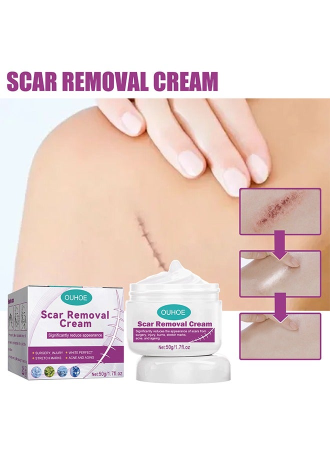 أوهو كريم الندبات تتلاشى كريم إصلاح الندبات الجراحية ، تفتيح الندوب الجراحية ، إصلاح البشرة الناعم ، 50 جم - Image 1