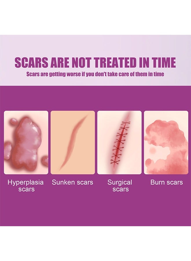 أوهو كريم الندبات تتلاشى كريم إصلاح الندبات الجراحية ، تفتيح الندوب الجراحية ، إصلاح البشرة الناعم ، 50 جم - Image 4