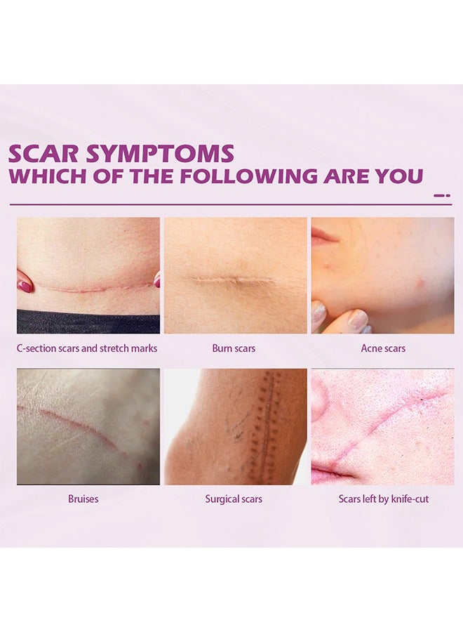 أوهو كريم الندبات تتلاشى كريم إصلاح الندبات الجراحية ، تفتيح الندوب الجراحية ، إصلاح البشرة الناعم ، 50 جم - Image 5