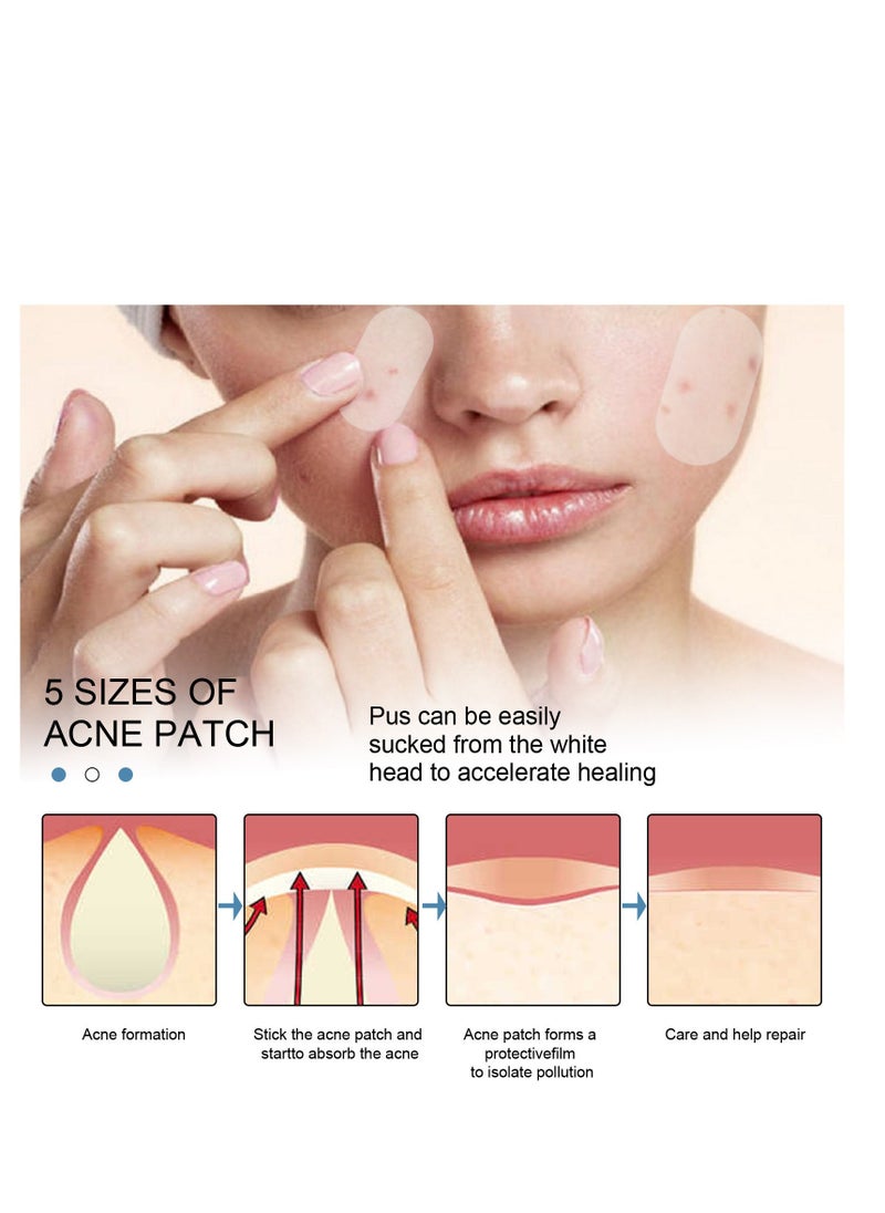 EELHOE Large Pimple Patches (5 Sizes 80 Patches), Acne Patches for Face, Chin, Back or Body, Hydrocolloid Patches Suitable for All Skin Types - Image 3