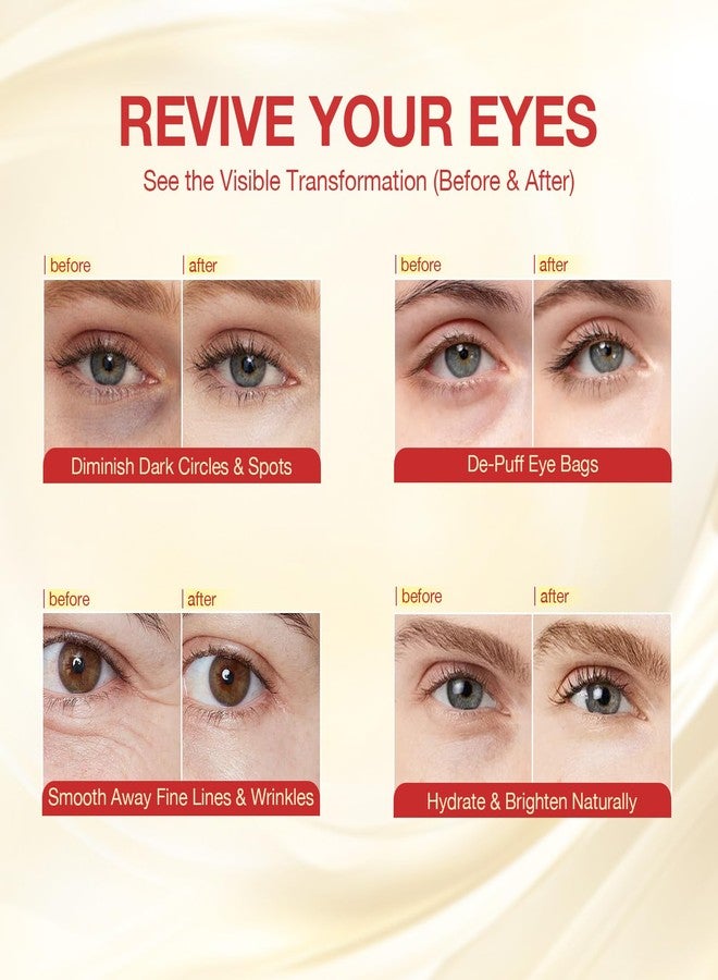 GONIM Under Eye Patches 360° Fit, Eye Mask with Collagen Peptide, PDRN, Retinol & Niacinamide, Eye Patches for Puffy Eyes and Dark Circles, Wrinkle Reduce for Women, Individually Packages 4 Pack - Image 3