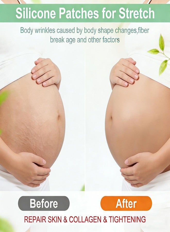 VolksRose Reusable Silicone Belly Patch for Lifting - Stomach tape for Postpartum Recovery & Stretch Marks, Moisturizing Anti-Wrinkle Skin Tape for Tummy Shaping, Firming & Invisible Wear Overnight - Image 5