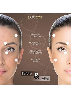 Pura d'or Pura D’Or Tamanu Oil (4Oz / 118Ml) Usda Organic Certified 100% Pure Natural Hexane Free Premium Grade Moisturizer Helps Reduce Appearance Of Scars From Psoriasis Eczema & Acne (Packaging May Vary)  - Image 5
