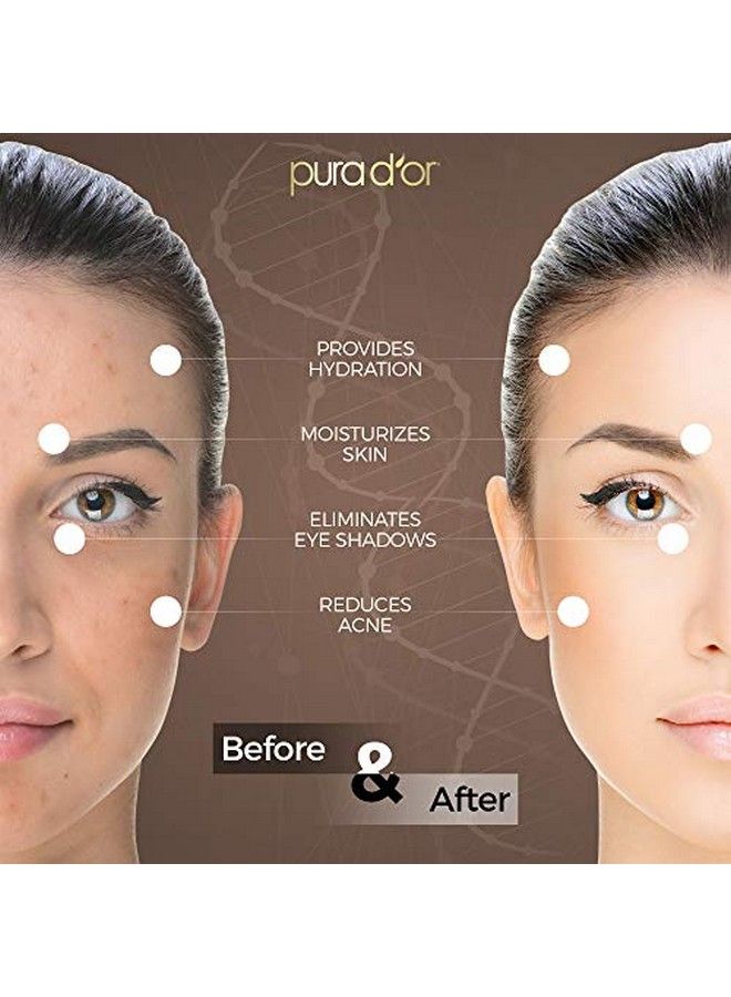 Pura d'or Pura D’Or Tamanu Oil (4Oz / 118Ml) Usda Organic Certified 100% Pure Natural Hexane Free Premium Grade Moisturizer Helps Reduce Appearance Of Scars From Psoriasis Eczema & Acne (Packaging May Vary) - Image 5