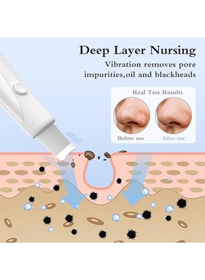 جهاز تقشير البشرة وملعقة تنظيف الوجه لإزالة الرؤوس السوداء وتنظيف المسام بعمق للعناية بالبشرة - Image 2