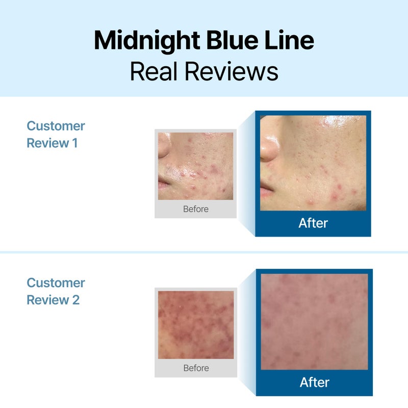 DearKlairs Midnight Blue Calming Cream â€“ Soothing Face Moisturizer for Oily & Sensitive Skin, Redness Relief & Hydrating, Lightweight Texture, 1.05 Fl Oz - Image 2